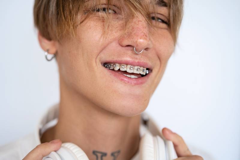 Cosmetic Braces: How Can They Improve My Smile?