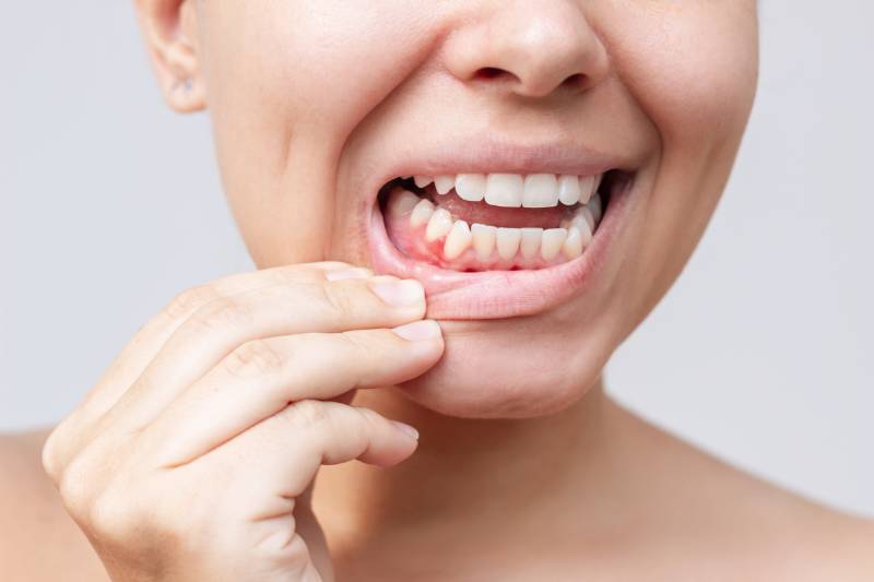 The Most Effective Gum Treatments in the UK for a Healthier, More Beautiful Look