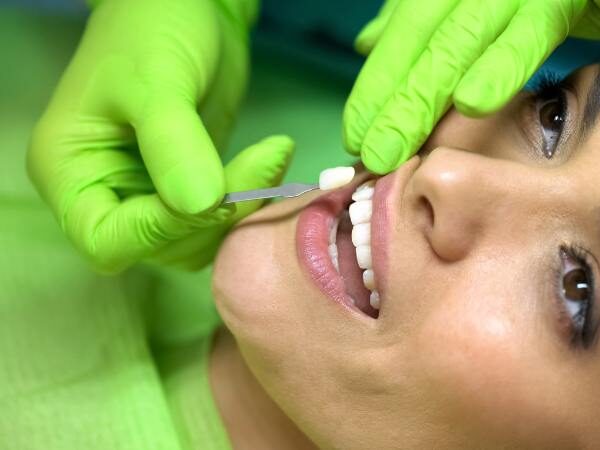 The Best Porcelain Veneers: How to Choose the Right Cosmetic Dentist for You